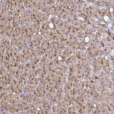 Immunohistochemistry: Catalase Antibody [NBP2-38772]