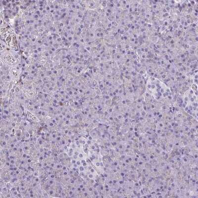 Immunohistochemistry-Paraffin: Catalase Antibody [NBP2-38772]