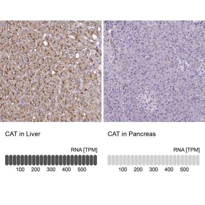 Immunohistochemistry-Paraffin: Catalase Antibody [NBP2-38772]