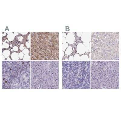 Immunohistochemistry-Paraffin: Catalase Antibody [NBP2-38772]