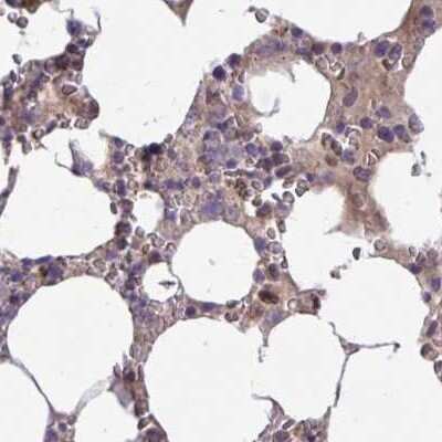 Immunohistochemistry-Paraffin: Catalase Antibody [NBP2-38772]