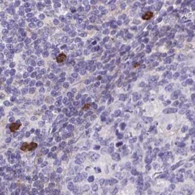 Immunohistochemistry-Paraffin: Catalase Antibody [NBP2-38772]