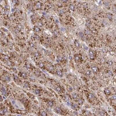 Immunohistochemistry-Paraffin: Catalase Antibody [NBP2-38772]