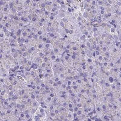 Immunohistochemistry-Paraffin: Catalase Antibody [NBP2-38772]