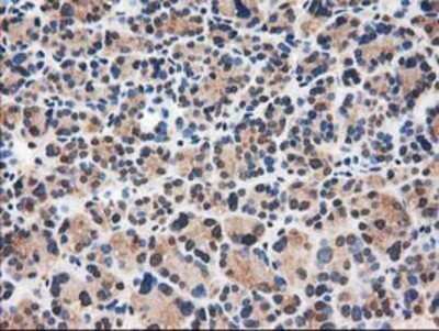 Immunohistochemistry: Catalase Antibody (OTI1B8) - Azide and BSA Free [NBP2-70342]