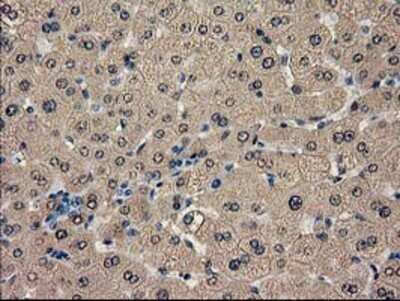 Immunohistochemistry: Catalase Antibody (OTI1B8) - Azide and BSA Free [NBP2-70342]