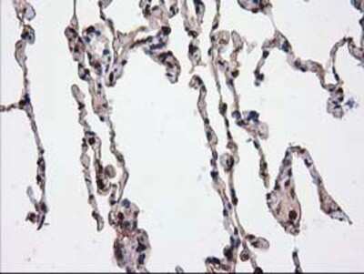 Immunohistochemistry: Catalase Antibody (OTI1B8) - Azide and BSA Free [NBP2-70342]