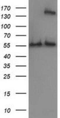 Western Blot: Catalase Antibody (OTI1B8)Azide and BSA Free [NBP2-70342]