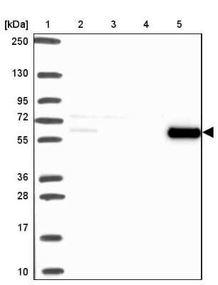 Western Blot: Catalase Antibody [NBP2-38772]