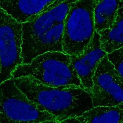 Immunocytochemistry/ Immunofluorescence: Catenin alpha 1 Antibody [NBP2-56460]