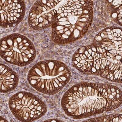 Immunohistochemistry: Catenin alpha 1 Antibody [NBP2-33456]
