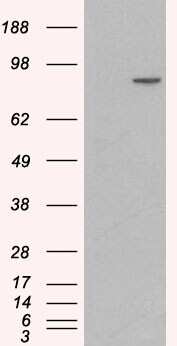 Western Blot: Catenin alpha 1 Antibody [NB100-2917]