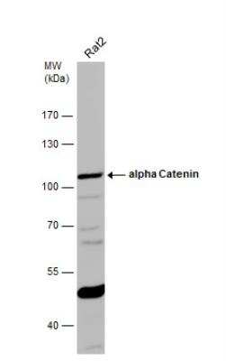 Western Blot: Catenin alpha 1 Antibody [NBP2-15723]