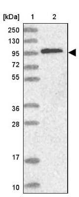Western Blot: Catenin alpha 1 Antibody [NBP2-33456]