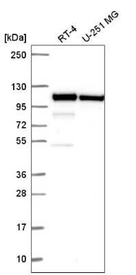 Western Blot: Catenin alpha 1 Antibody [NBP2-56460]