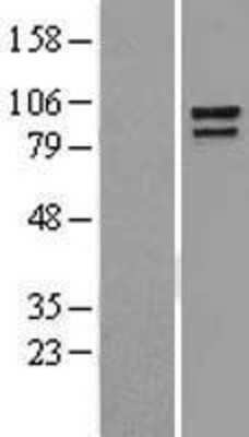 Western Blot: Catenin alpha 1 Overexpression Lysate [NBL1-09575]