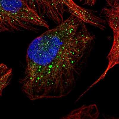 Immunocytochemistry/ Immunofluorescence: Cathepsin A/Lysosomal Carboxypeptidase A Antibody [NBP1-89728]