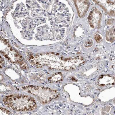 Immunohistochemistry-Paraffin: Cathepsin A/Lysosomal Carboxypeptidase A Antibody [NBP1-89728]