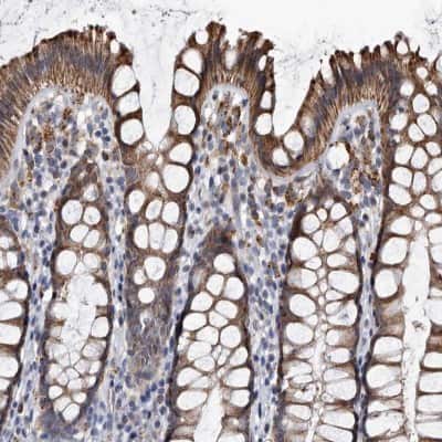 Immunohistochemistry-Paraffin: Cathepsin A/Lysosomal Carboxypeptidase A Antibody [NBP1-89728]