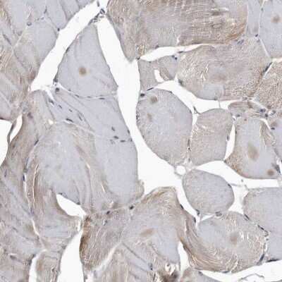 Immunohistochemistry-Paraffin: Cathepsin A/Lysosomal Carboxypeptidase A Antibody [NBP1-89728]