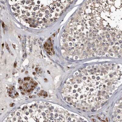 Immunohistochemistry-Paraffin: Cathepsin A/Lysosomal Carboxypeptidase A Antibody [NBP1-89728]