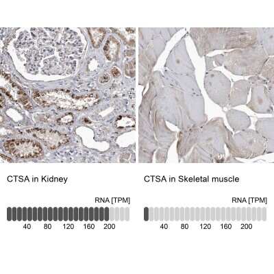 Immunohistochemistry-Paraffin: Cathepsin A/Lysosomal Carboxypeptidase A Antibody [NBP1-89728]