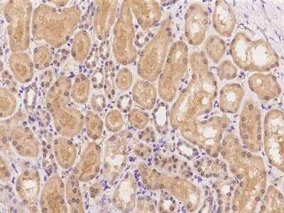 Immunohistochemistry-Paraffin: Cathepsin A/Lysosomal Carboxypeptidase A Antibody [NBP2-98190]