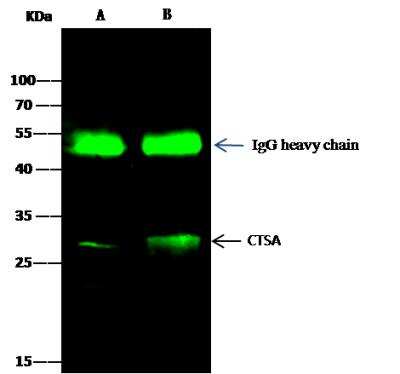 Immunoprecipitation: Cathepsin A/Lysosomal Carboxypeptidase A Antibody [NBP2-98264]