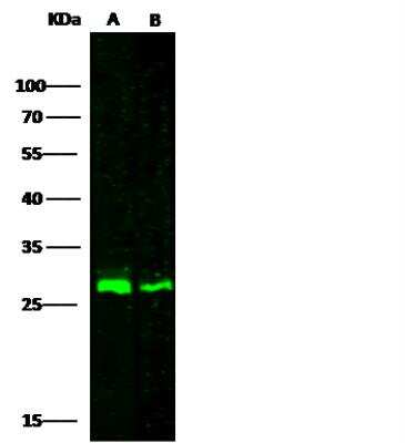Western Blot: Cathepsin A/Lysosomal Carboxypeptidase A Antibody [NBP2-98264]
