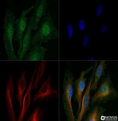 Immunocytochemistry/ Immunofluorescence: Cathepsin B Antibody - BSA Free [NBP1-19797]