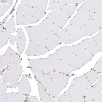 Immunohistochemistry-Paraffin: Cathepsin B Antibody [NBP1-86048]