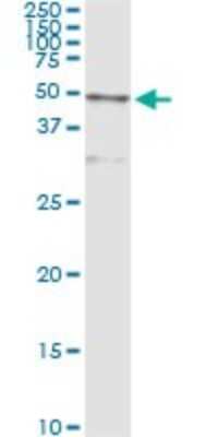 Immunoprecipitation: Cathepsin D Antibody (3F12-1B9) [H00001509-M01]