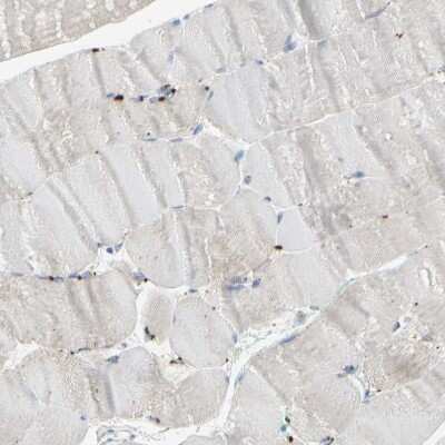 Immunohistochemistry-Paraffin: Cathepsin D Antibody [NBP1-85562]