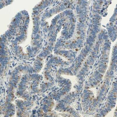 Immunohistochemistry-Paraffin: Cathepsin D Antibody [NBP1-85562]