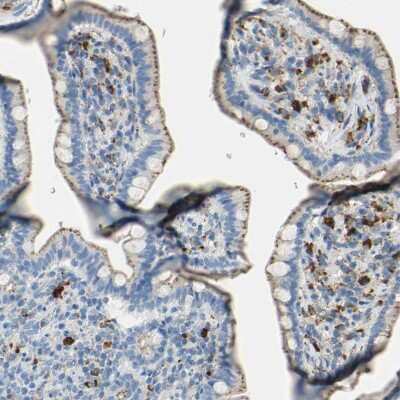 Immunohistochemistry-Paraffin: Cathepsin D Antibody [NBP1-85562]