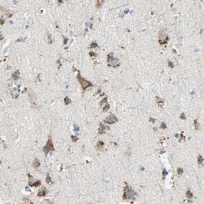 Immunohistochemistry-Paraffin: Cathepsin D Antibody [NBP1-85562]
