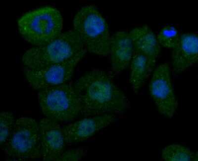 Immunocytochemistry/ Immunofluorescence: Cathepsin D Antibody (SU0360) [NBP2-67477]