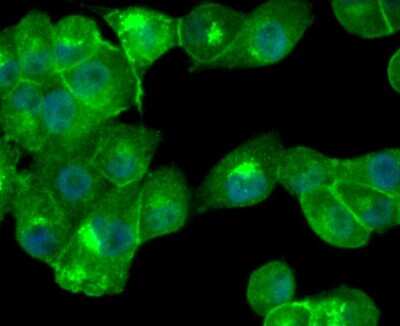 Immunocytochemistry/ Immunofluorescence: Cathepsin D Antibody (SU0360) [NBP2-67477]