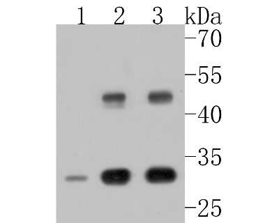 Western Blot: Cathepsin D Antibody (SU0360) [NBP2-67477]
