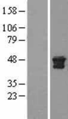 Western Blot: Cathepsin D Overexpression Lysate [NBL1-09590]