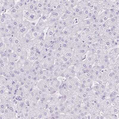 Immunohistochemistry-Paraffin: Cathepsin E Antibody [NBP2-33868]