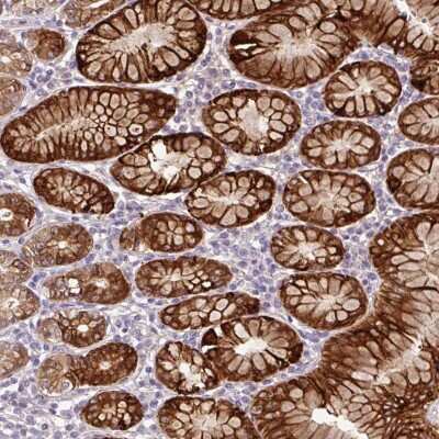 Immunohistochemistry-Paraffin: Cathepsin E Antibody [NBP2-33868]