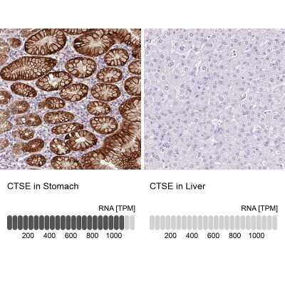 Immunohistochemistry-Paraffin: Cathepsin E Antibody [NBP2-33868]