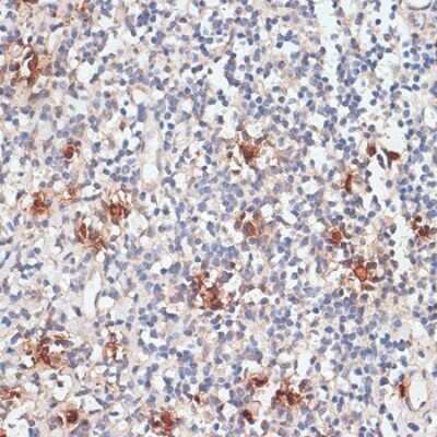 Immunohistochemistry-Paraffin: Cathepsin G Antibody - Azide and BSA Free [NBP2-92713]