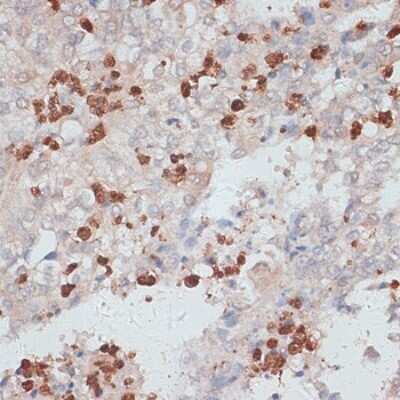 Immunohistochemistry-Paraffin: Cathepsin G Antibody - Azide and BSA Free [NBP2-92713]