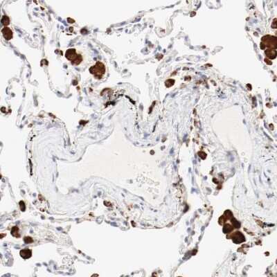 Immunohistochemistry-Paraffin: Cathepsin H Antibody [NBP1-90273]