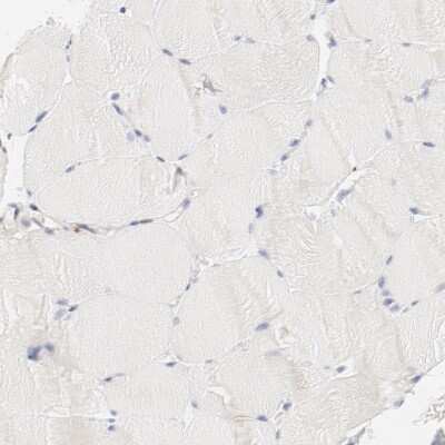 Immunohistochemistry-Paraffin: Cathepsin H Antibody [NBP1-90273]