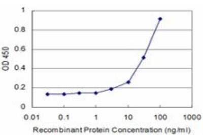 ELISA: Cathepsin K Antibody (2F1) [H00001513-M01]