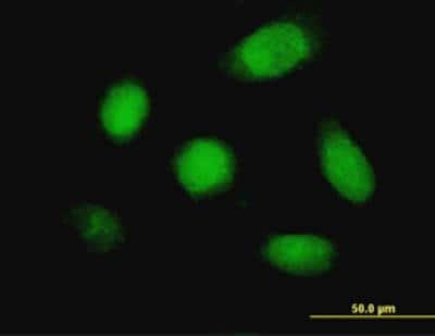 Immunocytochemistry/ Immunofluorescence: Cathepsin K Antibody (2F1) [H00001513-M01]