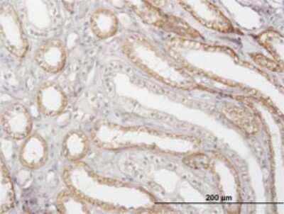 Immunohistochemistry-Paraffin: Cathepsin K Antibody (2F1) [H00001513-M01]